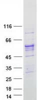 Human ALDH1B1 Protein (Recombinant Myc-DDK (Flag))