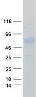 Human CD27 Protein (Recombinant Myc-DDK (Flag))