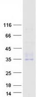 Human CD302 Protein (Recombinant Myc-DDK (Flag))