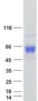 Human CD33 Protein (Recombinant Myc-DDK (Flag))