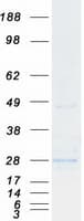 Human CD69 Protein (Recombinant Myc-DDK (Flag))