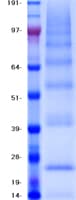 Human CD81 Protein (Recombinant Myc-DDK (Flag))