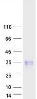 Human CD83 Protein (Recombinant Myc-DDK (Flag))
