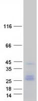 Human CD9 Protein (Recombinant Myc-DDK (Flag))