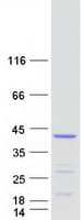 Human CNN2 Protein (Recombinant Myc-DDK (Flag))