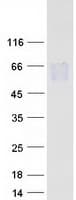 Human CNTFR Protein (Recombinant Myc-DDK (Flag))