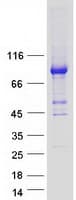 Human CPT1A Protein (Recombinant Myc-DDK (Flag))