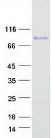 Human CSF1 / MCSF Protein (Recombinant Myc-DDK (Flag))