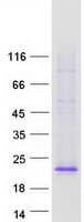 Human EDA / Ectodysplasin A Protein (Recombinant Myc-DDK (Flag))