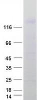 Human EGF Protein (Recombinant Myc-DDK (Flag))