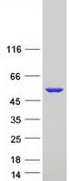 Human EPHX1 / Epoxide Hydrolase 1 Protein (Recombinant Myc-DDK (Flag))