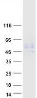 Human DSPG3 / Epiphycan Protein (Recombinant Myc-DDK (Flag))
