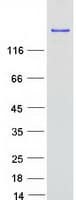 Human FASN / Fatty Acid Synthase Protein (Recombinant Myc-DDK (Flag))