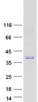 Human FOXI1 Protein (Recombinant Myc-DDK (Flag))