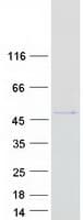 Human GSK3B / GSK3 Beta Protein (Recombinant Myc-DDK (Flag))