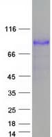 Human ITGB2 / CD18 Protein (Recombinant Myc-DDK (Flag))