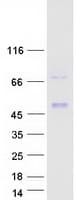 Human Lumican Protein (Recombinant Myc-DDK (Flag))