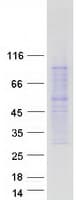 Human MC4R / Melanocortin 4 Receptor Protein (Recombinant Myc-DDK (Flag))