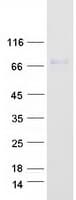 Human MMP2 Protein (Recombinant Myc-DDK (Flag))