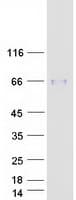 Human PLTP Protein (Recombinant Myc-DDK (Flag))