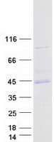 Human PRKACA Protein (Recombinant Myc-DDK (Flag))