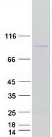 Human PYGM Protein (Recombinant Myc-DDK (Flag))