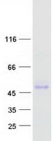 Human SERPINF1 / PEDF Protein (Recombinant Myc-DDK (Flag))