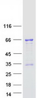 Human TCF3 / E2A Protein (Recombinant Myc-DDK (Flag))