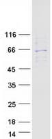 Human TROVE2 Protein (Recombinant Myc-DDK (Flag))