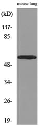 Polyclonal Rabbit anti-Human ALDH1A1 / ALDH1 Antibody (WB)
