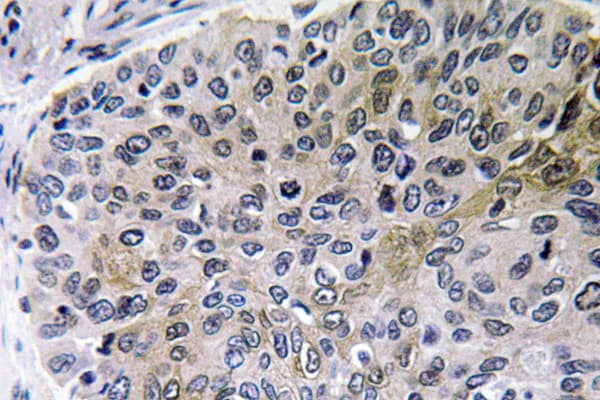 Polyclonal Rabbit anti-Human NGF Antibody (IHC, WB)