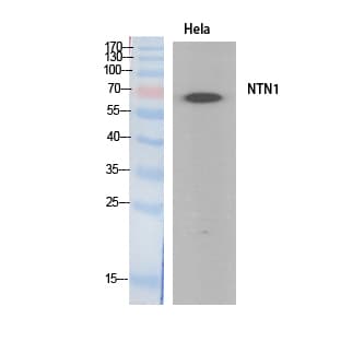 Polyclonal Rabbit anti-Human NTN1 / Netrin 1 Antibody (WB)