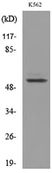 Polyclonal Rabbit anti-Human PROC / Protein C Antibody (WB)