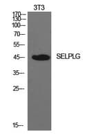 Polyclonal Rabbit anti-Human SELPLG / PSGL-1 / CD162 Antibody (WB)