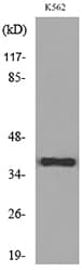 Polyclonal Rabbit anti-Human CD1C Antibody (WB)