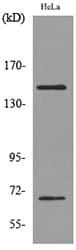 Polyclonal Rabbit anti-Human GP1BA / CD42b Antibody (WB)