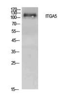Polyclonal Rabbit anti-Human ITGA5/Integrin Alpha 5/CD49e Antibody (WB)