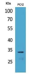 Polyclonal Rabbit anti-Human CD74 / CLIP Antibody (WB)
