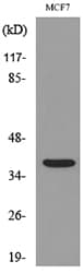 Polyclonal Rabbit anti-Human CD79B / CD79 Beta Antibody (WB)