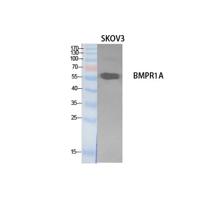 Polyclonal Rabbit anti-Human ALK3 / BMPR1A Antibody (WB)