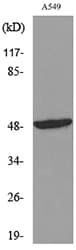 Polyclonal Rabbit anti-Human FOXA1 Antibody (WB)