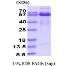Human SMAD2 Protein (Recombinant His)
