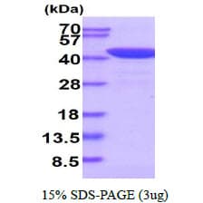 Human SERPINB5 / Maspin Protein (Recombinant His)