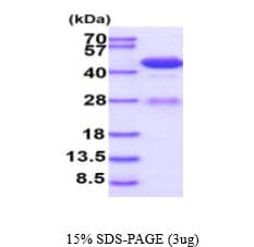 Human ADA / Adenosine Deaminase Protein (Recombinant His)