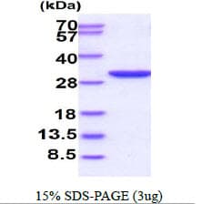 Human PGAM2 Protein (Recombinant His)