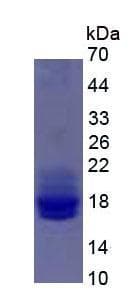 Rat Human interleukin 2 gene, clone pATtacIL-2C/2TT, complete cds, clone pATtacIL-2C/2TT. Protein (Recombinant)