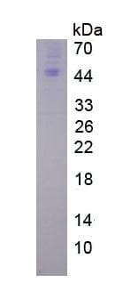 Human BAFF Receptor / CD268 Protein (Recombinant)