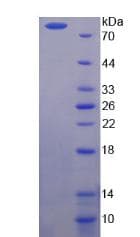 Human CSF1 / MCSF Protein (Recombinant His-GST-S)