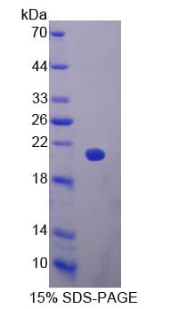 Rat GP9 / CD42a Protein (Recombinant His-T7)