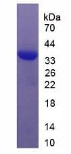Human SRF / Serum Response Factor Protein (Recombinant His-T7)